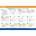 Twin Bag CAPD exchange procedure - Poster (English/French) Twin Bag CAPD exchange procedure - Poster (English/French)
