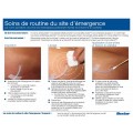 Routine Exit Site Care Handout  (French) NEW