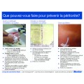 What Can You Do To Prevent Peritonitis?  (FRENCH) NEW